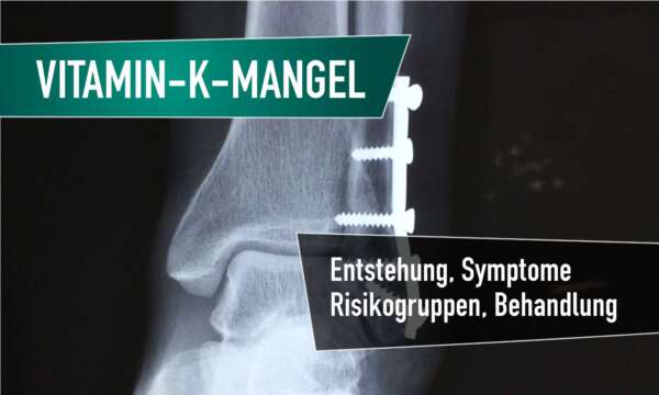 vitamin k mangel